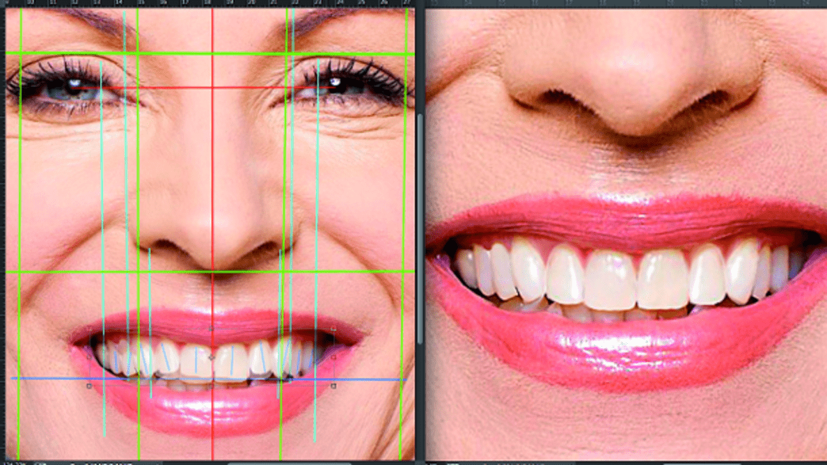 what is digital smile design